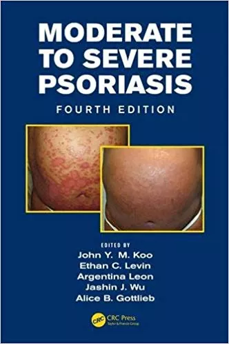 Moderate to Severe Psoriasis  4th Edition 2014 By John Y. M. Koo