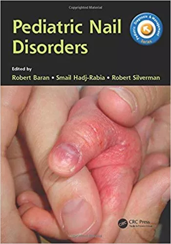 Pediatric Nail Disorders 2016 By Robert Baran