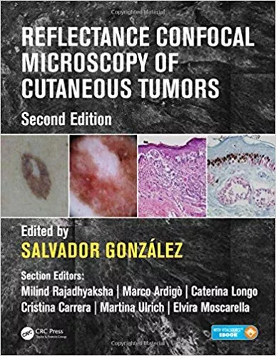 Reflectance Confocal Microscopy of Cutaneous Tumors 2nd Edition 2017 By Salvador Gonzalez