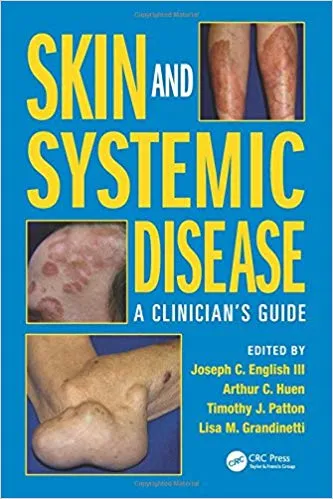 Skin and Systemic Disease: A Clinician’s Guide 2015 By Joseph C. English III