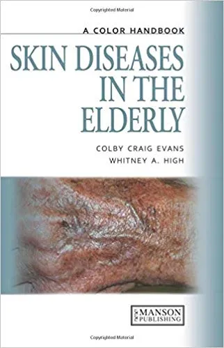 Skin Diseases in the Elderly: A Color Handbook 2011 By Skin Diseases in the Elderly: A Color Handbook