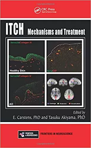 Itch: Mechanisms and Treatment 2014 By E.Carstens