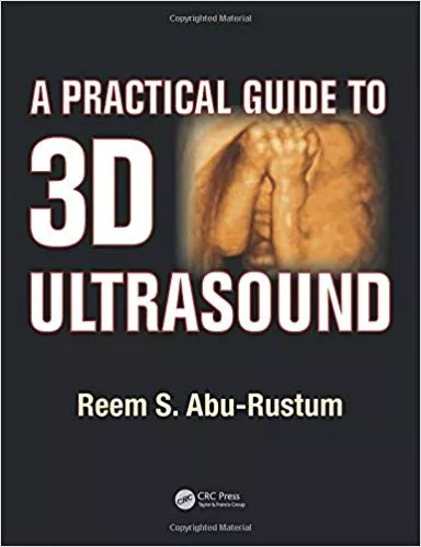 A Practical Guide to 3D Ultrasound 2015 By Reem S. Abu-Rustum