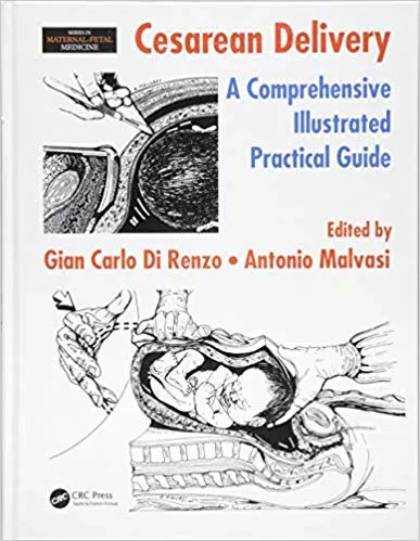 Cesarean Delivery: A Comprehensive Illustrated Practical Guide 2016 By Gian Carlo Di Renzo
