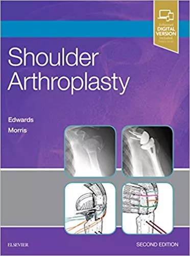Shoulder Arthroplasty 2nd Edition 2018 By T. Bradley Edwards MD