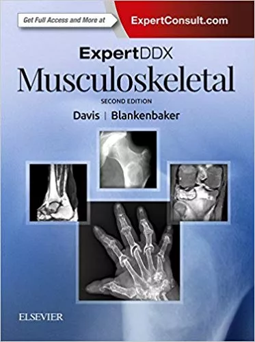ExpertDDx: Musculoskeletal 2nd Edition 2017 By Kirkland W. Davis