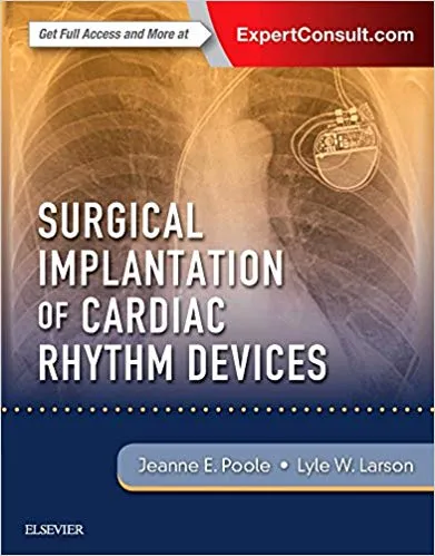Surgical Implantation of Cardiac Rhythm Devices 1st Edition 2017 By Jeanne Poole