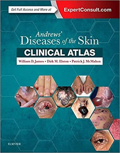 Andrews' Diseases of the Skin Clinical Atlas, 1st Edition 2017 By William D. James