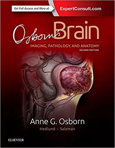 Osborn's Brain 2nd Edition 2017 By Anne G. Osborn