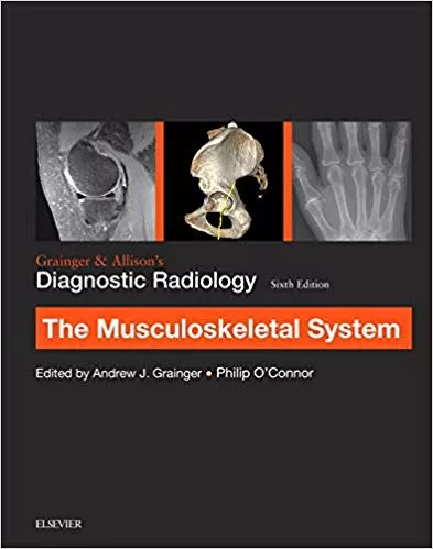 Grainger & Allison's Diagnostic Radiology: Musculoskeletal System  2015 By Andrew Grainger