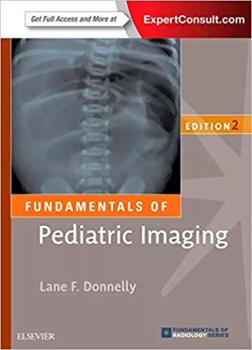 Fundamentals of Pediatric Imaging 2nd Edition 2016 By Lane F. Donnelly