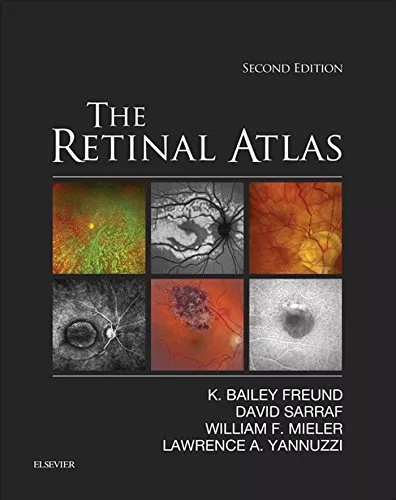 The Retinal Atlas 2nd Edition 2016 By K. Bailey Freund
