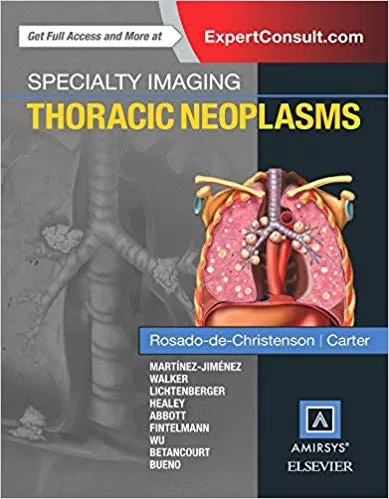 Specialty Imaging: Thoracic Neoplasms 2015 By Rosado-de-Christenson