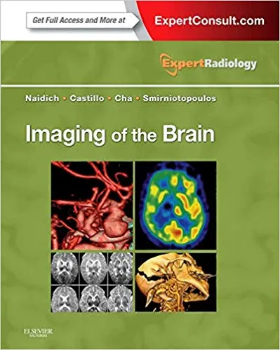 Imaging of the Brain: Expert Radiology Series 2012 By Thomas P. Naidich