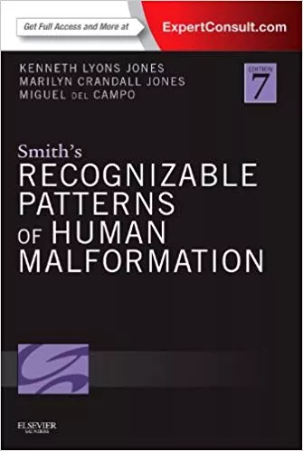 Smith's Recognizable Patterns of Human Malformation 7th Edition 2013 By Kenneth Lyons Jones