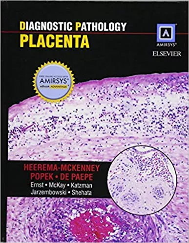 Diagnostic Pathology: Placenta 2014 By Amy Heerema McKenney
