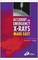 Accident and Emergency X-rays Made Easy, International Edition 2004 By Begg