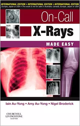 On-Call X-Rays Made Easy, International Edition 2010 By Au-Yong