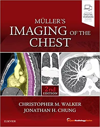 Muller's Imaging of the Chest 2nd Edition 2018 By Christopher M. Walker