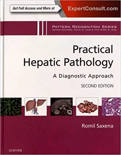 Practical Hepatic Pathology: A Diagnostic Approach: A Volume in the Pattern Recognition Series 2nd Edition 2017 By Romil Saxena