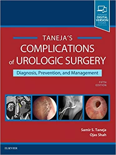 Complications of Urologic Surgery: Prevention and Management 5th Edition 2017 By Samir S. Taneja