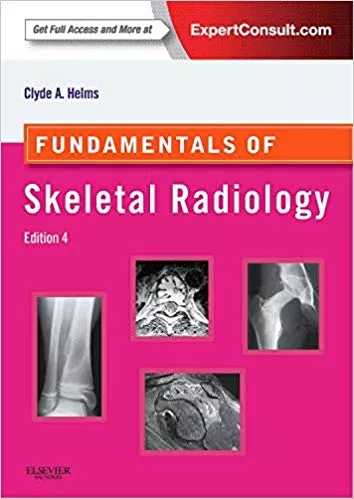 Fundamentals of Skeletal Radiology (Fundamentals of Radiology) 4th Edition 2013 By  Clyde A. Helms