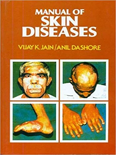 Manual of Skin Diseases 2018 By Deshore Jain