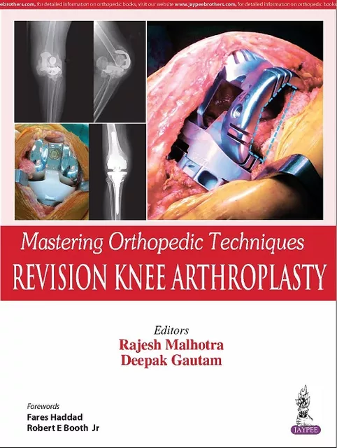 Mastering Orthopedic Techniques REVISION KNEE ARTHROPLASTY  by Rajesh Malhotra & Deepak Gautam