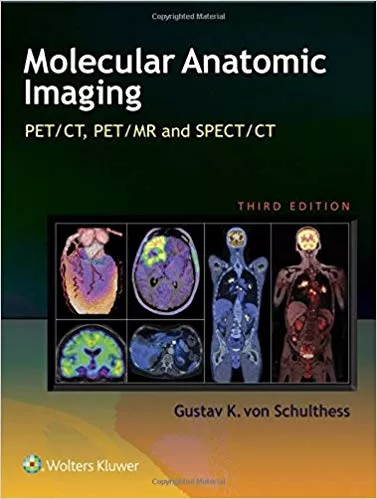 Molecular Anatomic Imaging: PET/CT, PET/MR and SPECT CT 2015 By Gustav K. Von Schulthess