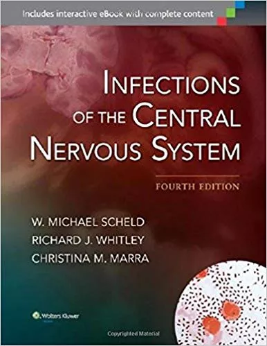 Infections Of The Central Nervous System 2014 By  W. Michael Scheld