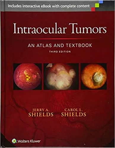 Intraocular Tumors: An Atlas and Textbook 3rd Edition 2015 By Jerry A. Shields