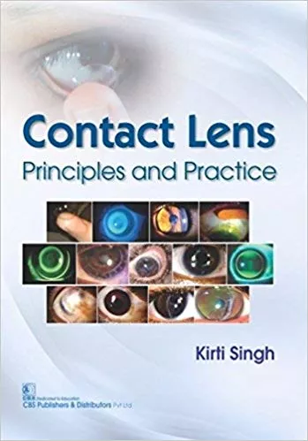 Contact Lens Principles And Practice 2017 By Singh K