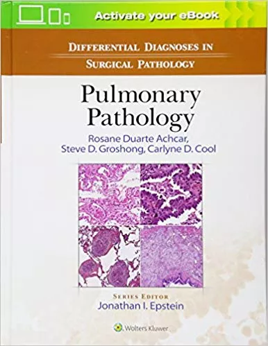 Differential Diagnosis in Surgical Pathology: Pulmonary Pathology By Rosane Duarte Achcar