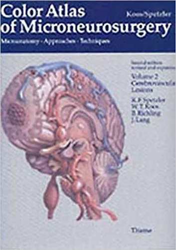 Color Atlas of Microneurosurgery: Cerebrovascular Lesions - Vol. 2: Cerebrovascular Lesions - Microanatomy, Approaches and Techniques - Vol. 2 By Robert F. Spetzler