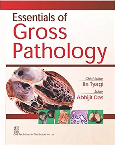 Essentials Of Gross Pathology 2017 By Tyagi