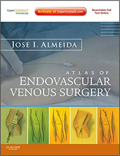 Atlas of Endovascular Venous Surgery: Expert Consult - Online and Print (Expert Consult Premium) 2012 By Jose Almeida