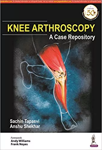 KNEE ARTHROSCOPY A Case Repository 1st Edition 2019 By Sachin Tapasvi & Anshu Shekhar