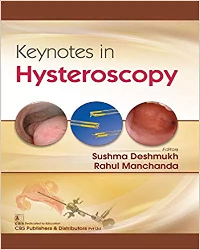 Keynotes in Hysteroscopy 2019 By Rahul Deshmukh