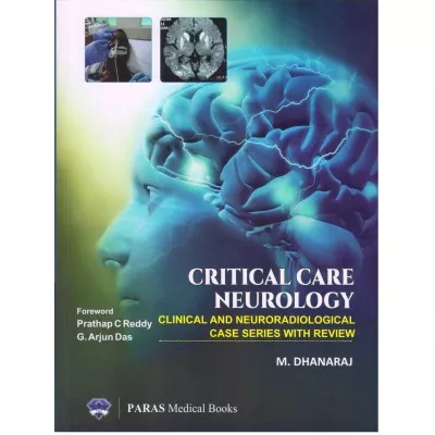 Critical Care Neurology: Clinical & Neuroradiological Case Series with Review 1st Edition 2019 by M Dhanaraj