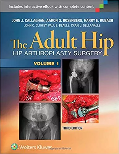 The Adult Hip (Two Volume Set): Hip Arthroplasty Surgery By Callaghan