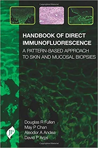 Handbook of Direct Immunofluorescence: A Pattern-Based Approach to Skin and Mucosal Biopsies 2018 by Douglas Fullen