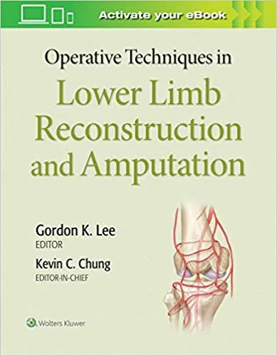 Operative Techniques in Lower Limb Reconstruction and Amputation 2019 By Kevin C Chung