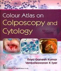 Colour Atlas on Colposcopy and Cytology By Priya Ganesh Kumar