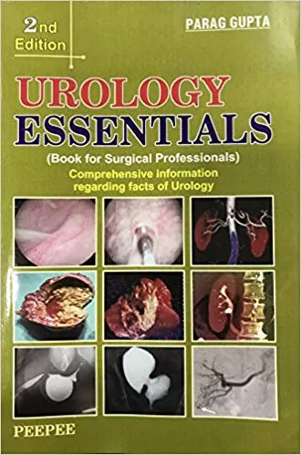 Urology Essentials 2nd Edition 2015 By Parag Gupta