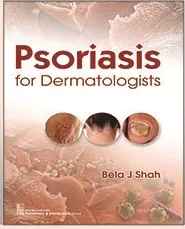 Psoriasis for Dermatologists 2020 By Bela J Shah