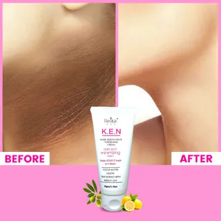 Revluk-Knee Elbow Neck Whitening Cream Whitening Cream, Dark Spot Correction, Knee and Elbow Private Parts Brightening Cream 50gm